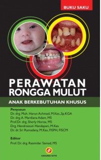 Perawatan Rongga Mulut Anak Berkebutuhan Khusus